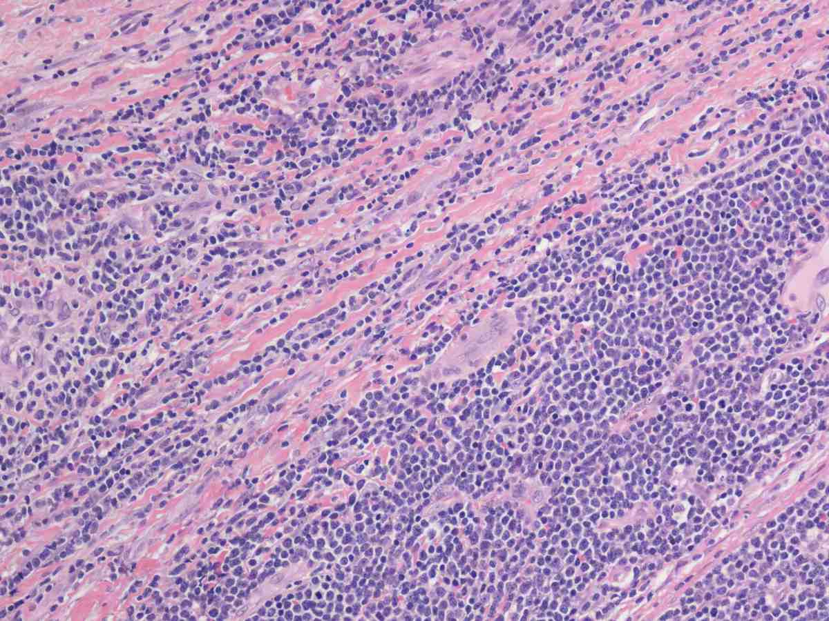 Lymph node 2012 20X HE